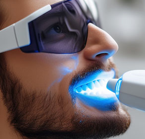 Sesiónes de Blanqueamiento Dental