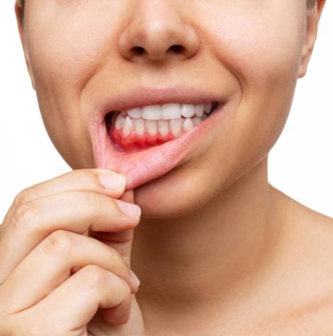 periodoncias-valladolid Periodoncias en Valladolid